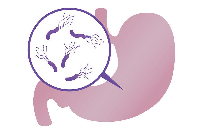 ピロリ菌の除菌