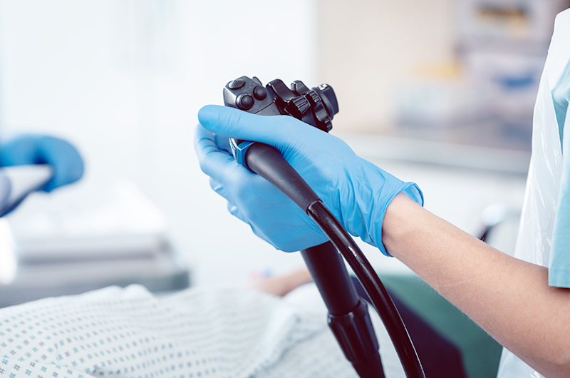 大腸カメラ検査