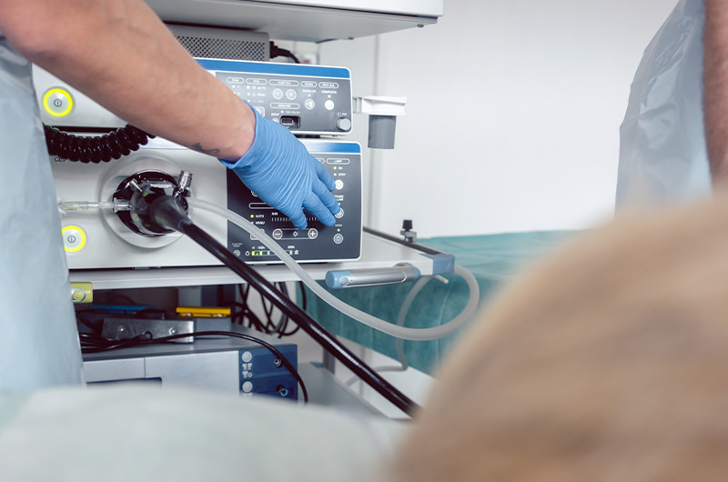 逆流性食道炎の検査方法